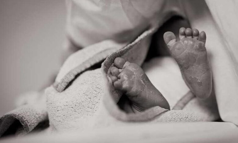 2 Fetuses Successfully Removed From Newborn's Abdomen In Maharashtra